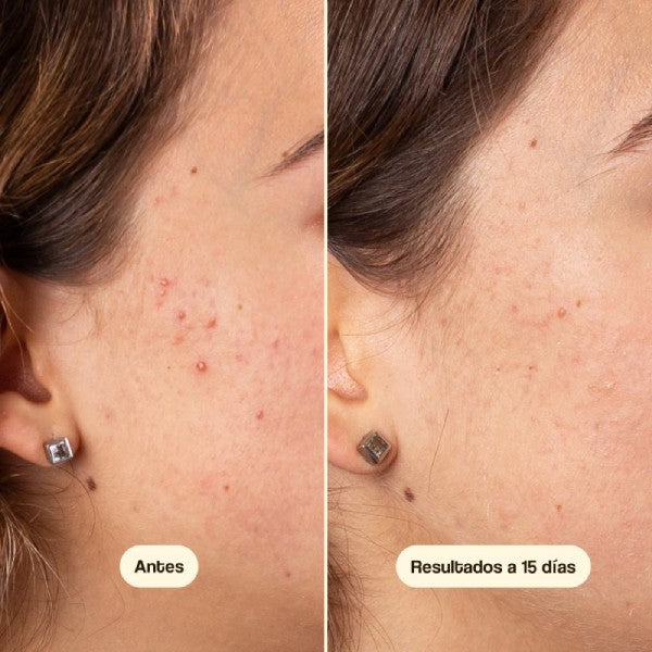 Azelaic Radiance Face Serum Freshly Cosmetics